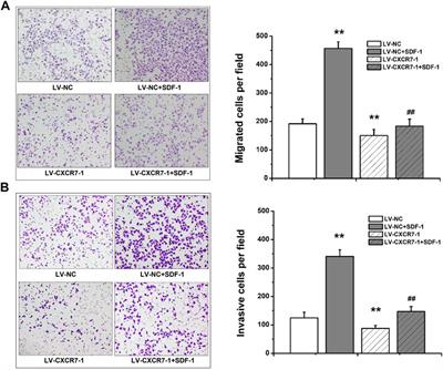 Effects of SDF-1/CXCR7 on the Migration, Invasion and Epithelial-Mesenchymal Transition of Gastric Cancer Cells